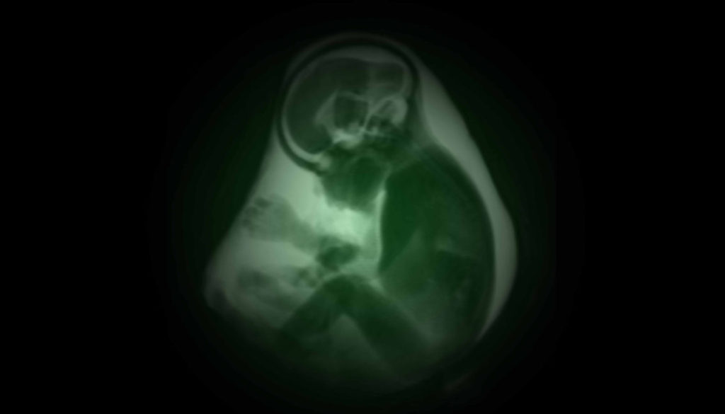 In Utero landscape